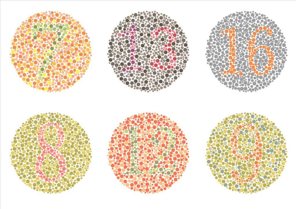 colour vision deficiency ishihara test